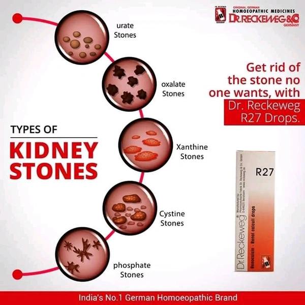 Dr. Reckeweg R27 Renal Calculi Drop - 22ml