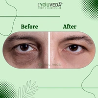 Akshi Peri-eye Serum Cream - Golden Tainoi, 15ml