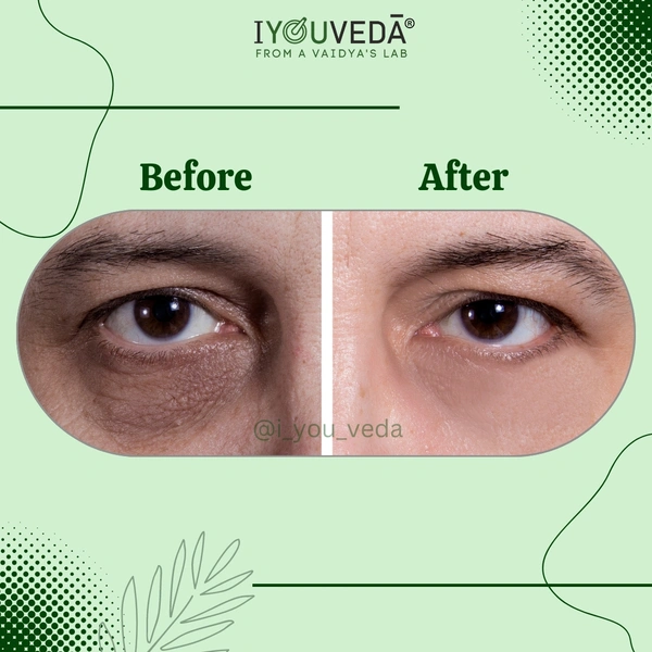 Akshi Peri-eye Serum Cream - Golden Tainoi, 15ml