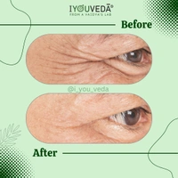 Akshi Peri-eye Serum Cream - Golden Tainoi, 15ml