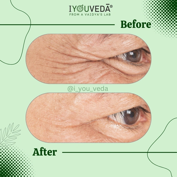 Akshi Peri-eye Serum Cream - Golden Tainoi, 15ml