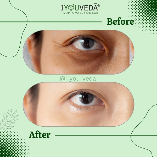 Akshi Peri-eye Serum Cream - Golden Tainoi, 15ml