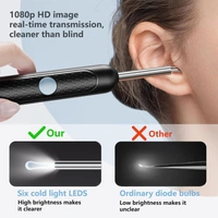 Ear Wax Removal Tool with 1080P HD Camera, LED Light Otoscope Ear Cleaner Kit, Endoscope Earwax Remover for iPhone & Android, Ear Cleaning Camera Tool for Adults & Kids (Multicolor)