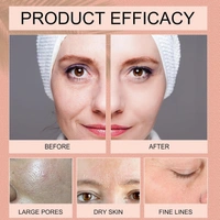 Bio-Collagen Overnight Face Mask|Korean Glass Skin Hydrogel Mask for Deep Hydration,Pigmentation,Anti-Aging&Pore Minimizing|Hyaluronic Acid,Niacinamide,Vitamin E&Centella