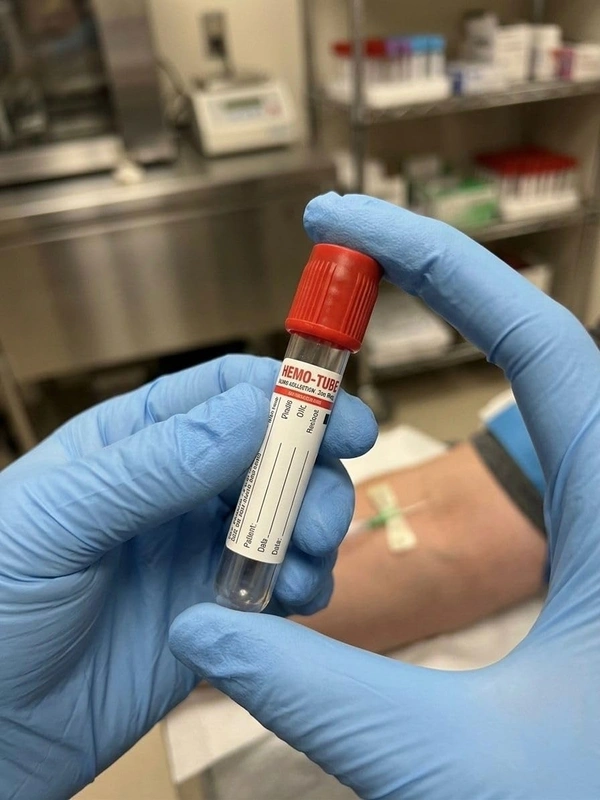 Fairbizps Store Non Vacuum Blood Collection Tube With Clot Activator Red Cap 4ml Sterile Serum Tubes Pack Of 100 For Lab Diagnostic Use - Red