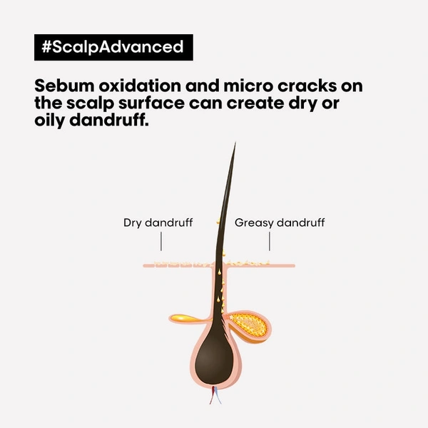 Loreal Professionnel Scalp Advanced Anti-Dandruff Dermo-Clarifier Shampoo - Formerly Instant Clear  Loreal Professionnel Scalp Advanced Anti-Dandruff Dermo-Clarifier Shampoo 300Ml
