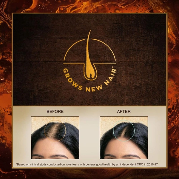 Indulekha  Hair Oil  Indulekha Bringha Hair Oil 50ml 
