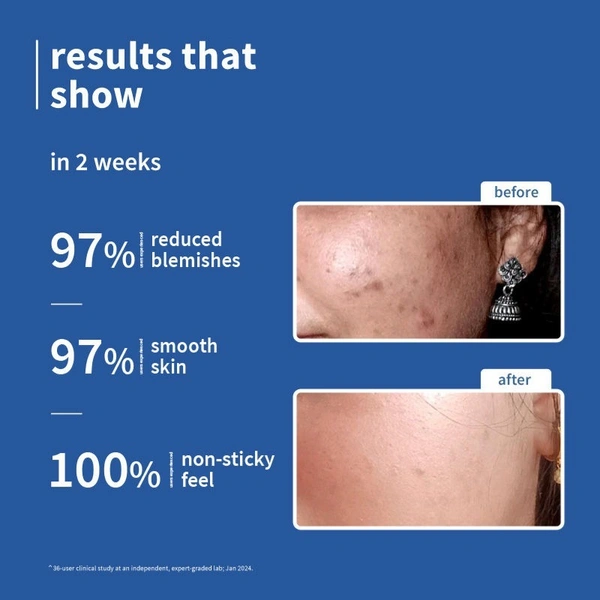 Plum 10% Niacinamide Brightening Face Serum With Rice Water For Oily To Dry Skin (50ml)