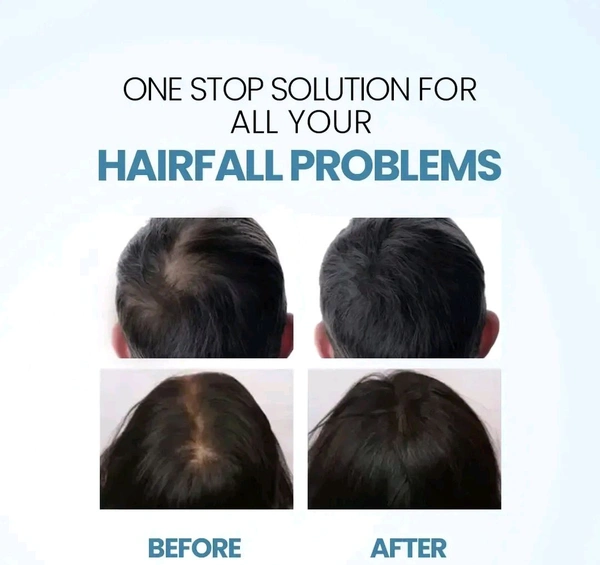 Nature Sure Jonk Hail Oil - 150 ML