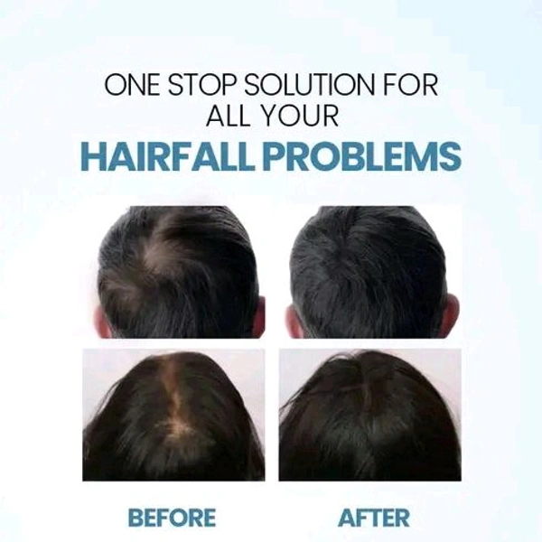 Nature Sure Jonk Tail Hair Oil for Men and Women - 1 Pack (150 ml)