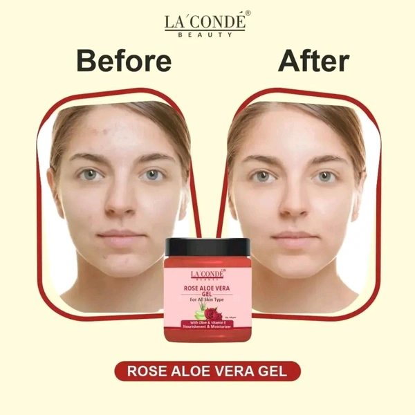 Beauty Rose Aloe Vera Face Gel For Skin Toning And Brightening - 100 Grams