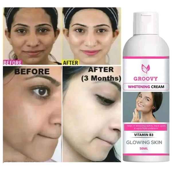 WHITENING CREAM FOR GLOWING SKIN 50ML (PACK OF 1)