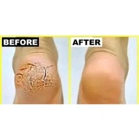 WaYFaR Foot Crack Cream For Dry Cracked Heels & Feet (50gm) Pack of 1