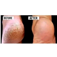 WaYFaR Foot Crack Cream For Dry Cracked Heels & Feet (50gm) Pack of 1