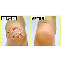 WaYFaR Foot Crack Cream For Dry Cracked Heels & Feet (50gm) Pack of 1