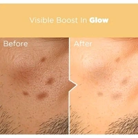 VITAMIN C FACE SERUM for Brightness - 30ml | Fades Dark Spots & Hydrates | For Oily, Dry, Normal & Combination Skin | Lightweight & Non-Sticky