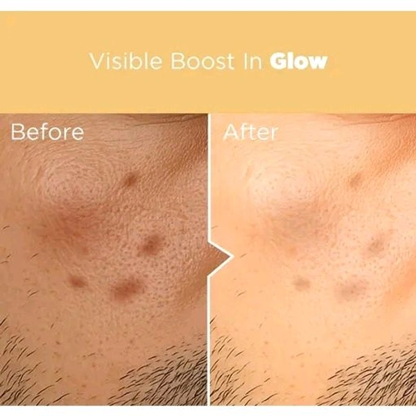 VITAMIN C FACE SERUM for Brightness - 30ml | Fades Dark Spots & Hydrates | For Oily, Dry, Normal & Combination Skin | Lightweight & Non-Sticky