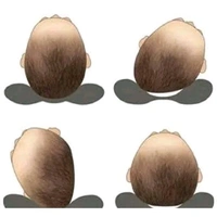 Mustard Seeds (Rai) Pillow Cotton,Baby Head Shaping Takiya Detachable Mustard/Rai Seed Pouch for Easy Washing Feeding & Nursing Baby Neck Pillow (Blue)