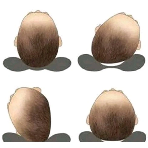 Mustard Seeds (Rai) Pillow Cotton,Baby Head Shaping Takiya Detachable Mustard/Rai Seed Pouch for Easy Washing Feeding & Nursing Baby Neck Pillow (Blue)