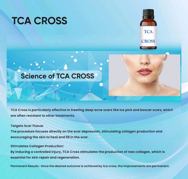 A TCA Cross 80% For Deep Acne Scars,Moles,Warts.