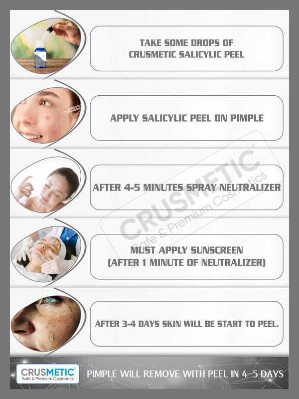 Salicylic Peel 15% For Pimples 10 ML