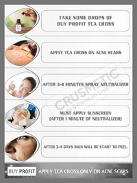 A Complete kit TCA CROSS 80% with Neutralizer & Glycolic With Kojic Acid Face Wash । Collagen Gel । Sunscreen SPF 50 - White