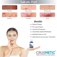 Salicylic Peel 15% For Pimples 10 ML