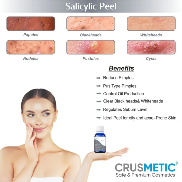 Salicylic Peel 15% For Pimples 10 ML