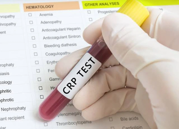 C-REACTIVE PROTEIN (CRP)