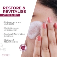 Alite Anti Acne Soap 75g | Fights Body Acne with Instant Microbial Action | Controls Excess Oil & Sebum | Deep Cleansing & Purifying Soap for Clear Skin