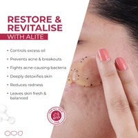 Alite Anti-Acne Face Wash 70g with Encapsulated Charcoal for Oily to Normal Skin | Detoxifies Pores | Daily Use Unisex Face Wash | Acne Control