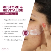 Alite Spots Reduction Cream 15g | Eliminates Dark Spots & Pigmentation | Brightens & Evens Skin Tone | Repairs Cells & Minimizes Pores | Probiotic Formula