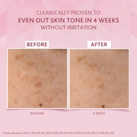 Cetaphil Brightening Day Protection Cream SPF 15-50g With Niacinamide for Uneven Skin Tone, Reduce Dark Spots