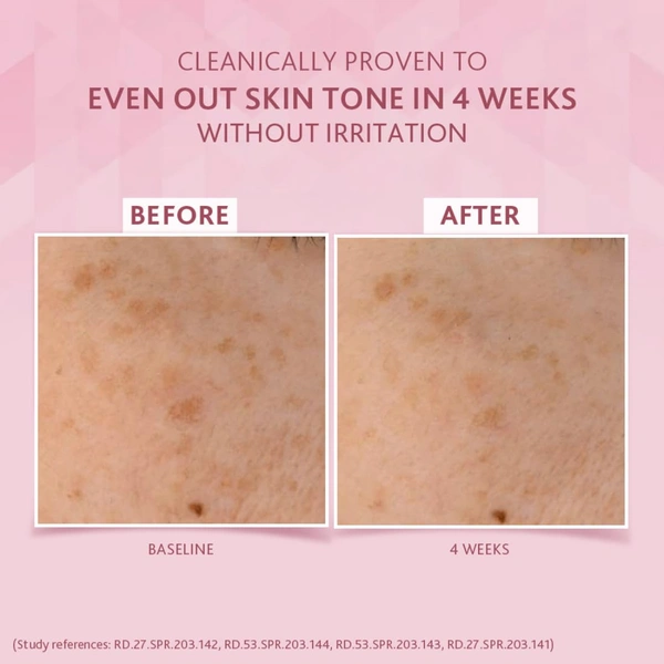 Cetaphil Brightening Day Protection Cream SPF 15-50g With Niacinamide for Uneven Skin Tone, Reduce Dark Spots