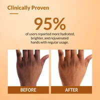 Fixderma Hand Cream 30g | Hand Moisturizer for Dry, Rough & Itchy Hands | Cocoa Butter Nourishing Hand Cream | Soft, Smooth, Hydrated Hands for Women & Men | Suitable for All Skin Types