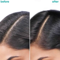 Matrix Biolage Scalppure Anti Dandruff Shampoo 400ml | Removes Dandruff & Scalp Buildup | Refreshing & Purifying Formula for Healthy Scalp - 1