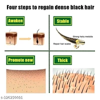 Shahensha Sales Adivasi Hair Oil Ginger & Hair Growth Ginger Ayurvedic Oil | Anti Hairfall Hair - Black, Free Size