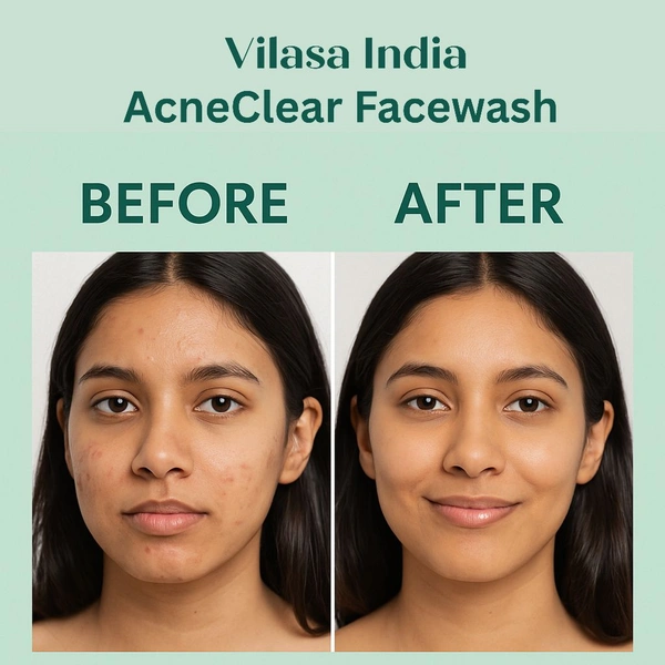 All In Once Acne Clear Facewash (100ml)