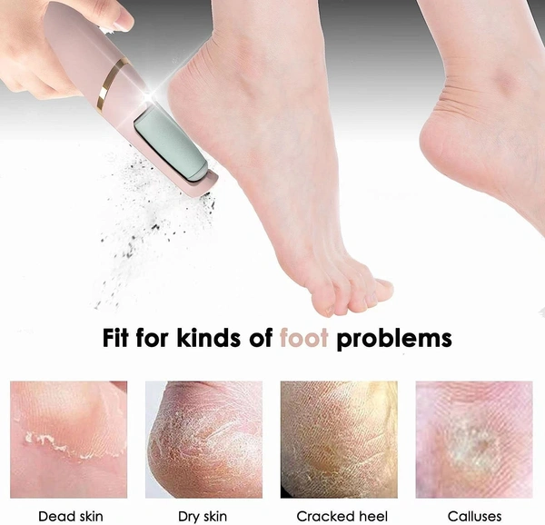 Electric Callus Remover: Rechargeable Foot File for Smooth Skin - Cordless Pedicure Tool to Remove Dry Coarse Skin, Calluses, and Corns on Heels