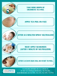 CRUSMETIC TCA 30% Peel- Exfoliate to Skin