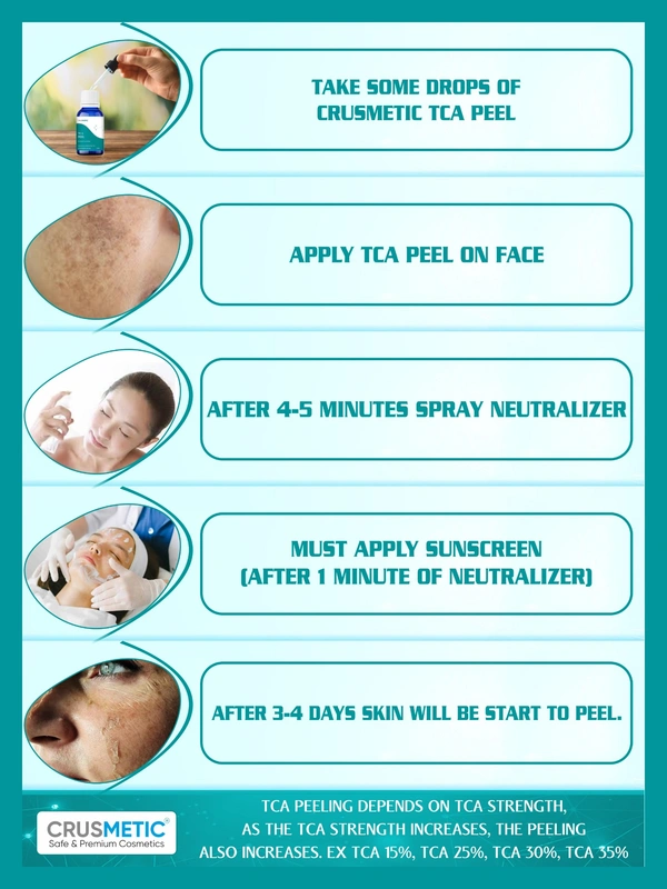 CRUSMETIC TCA 30% Peel- Exfoliate to Skin