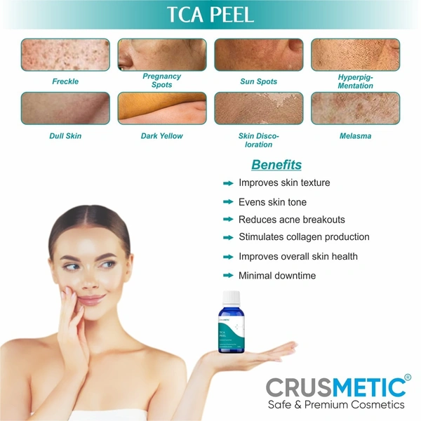 CRUSMETIC TCA 30% Peel- Exfoliate to Skin