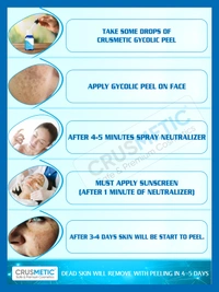 Crusmetic Glycolic Peel 70% - Exfoliate & Brighten Formula