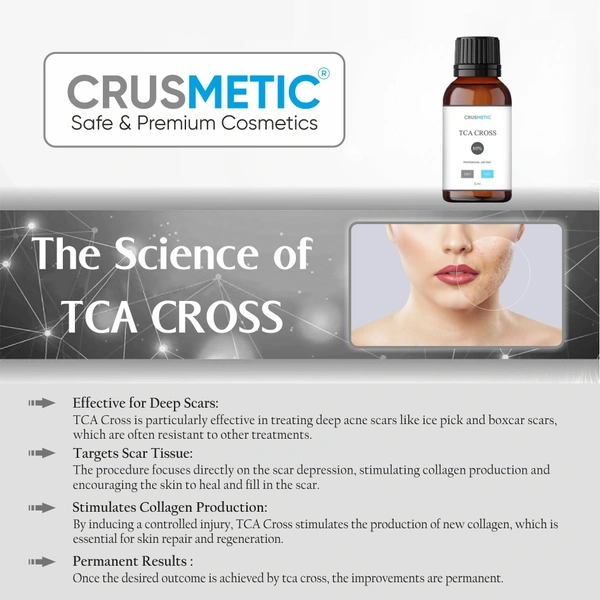 A TCA Cross 80% - Acne Scars Solution