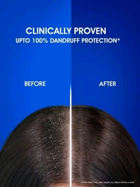 HEAD & SHOULDERS - शैम्पू, 5ml