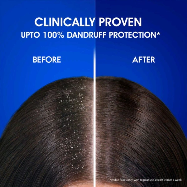 P&G. Head & Shoulders Anti-Dandruff Shampoo 340 ml + 170 ml Free.