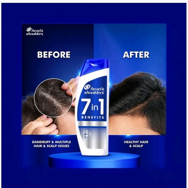 Head & Shoulders 7-in-1 Anti-Dandruff Shampoo - 180 ml