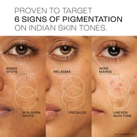 Lakme Perfect Radiance Serum ,30ml 