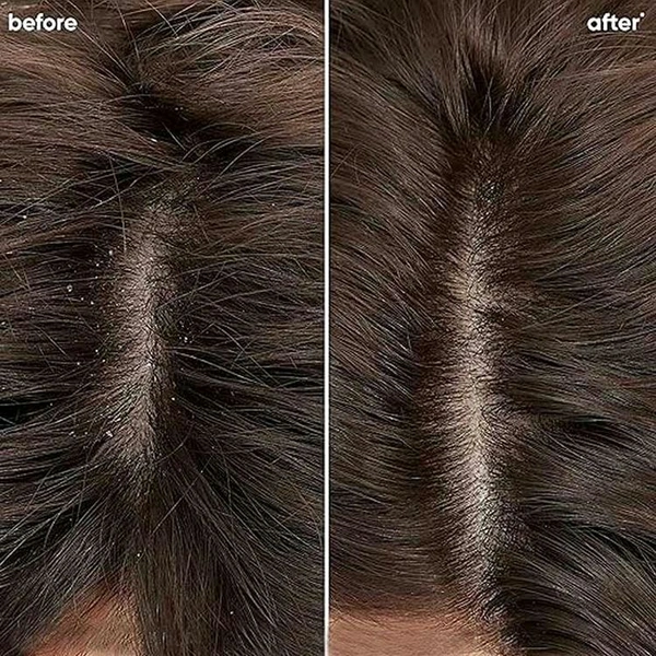 Biolage Scalppure Professional Anti-Dandruff Conditioner, 98gm