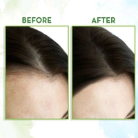 Mamaearth Rosemary Hair Growth Oil ,150ml 